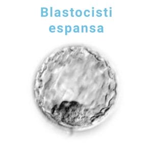blastocisti-espansa