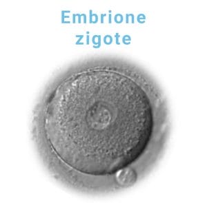 embrione-zigote